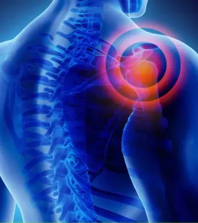 Rotator Cuff Injury