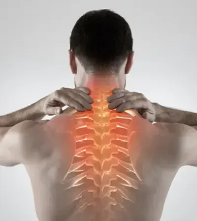 Spondylosis